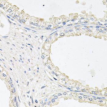 Anti-EPOR Antibody (CAB2917)