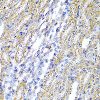 Anti-CYP20A1 Antibody (CAB6476)