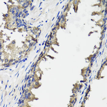 Anti-OTC Polyclonal Antibody (CAB9834)