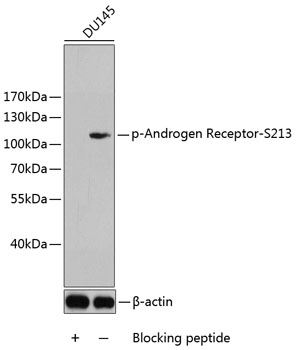 Anti-Phospho-Androgen receptor-S213 Antibody (CABP0306)