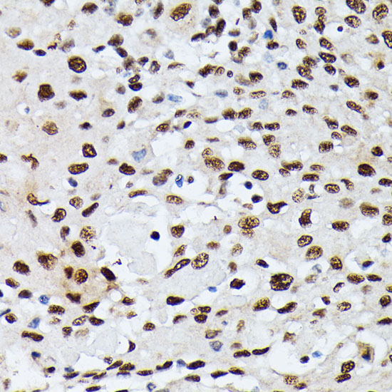 Anti-HNRNPM Antibody (CAB6937)