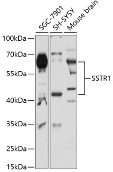 Anti-SSTR1 Antibody (CAB11659)