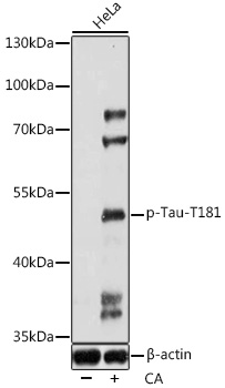 Anti-Phospho-MAPT-T498 pAb (CABP0895)