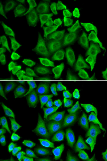 Anti-FAS Antibody (CAB12401)