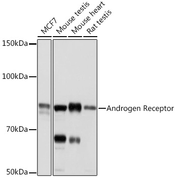 Anti-Androgen Receptor Antibody