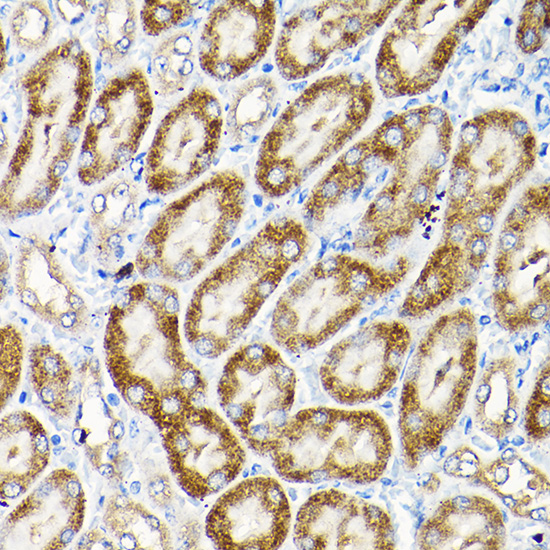 Anti-SCFD1 Polyclonal Antibody (CAB8835)