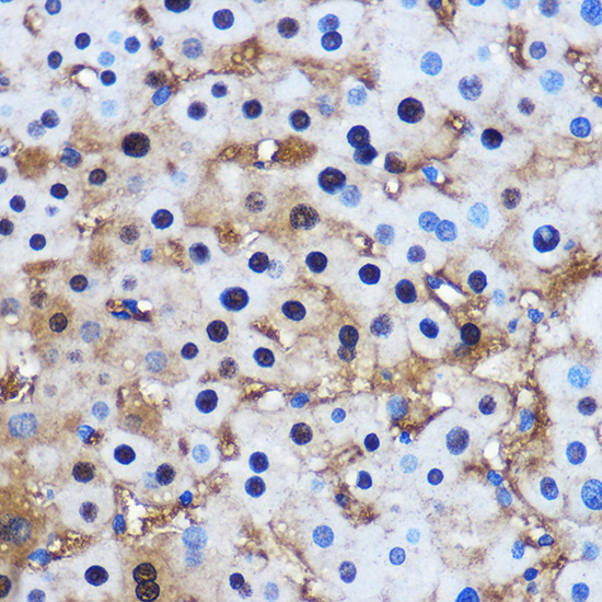 Anti-PPP1CB Antibody (CAB1088)