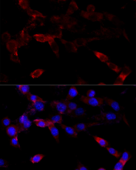 Anti-CYP1B1 Antibody (CAB1377)