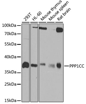 Anti-PPP1CC Antibody [KO Validated] (CAB4035)