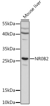 Anti-NR0B2 Antibody (CAB16454)