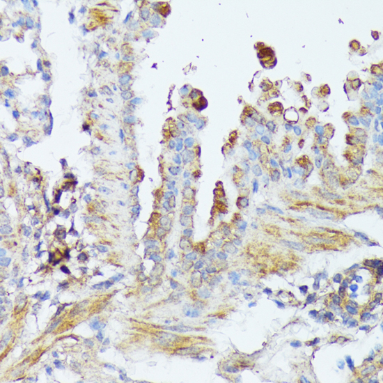 Anti-WNT1 Antibody (CAB2475)