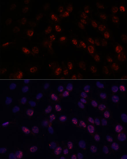 Anti-DDX24 Antibody (CAB15481)