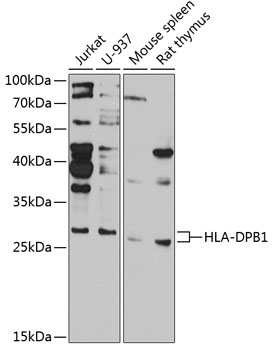 Anti-HLA-DPB1 Antibody (CAB13312)