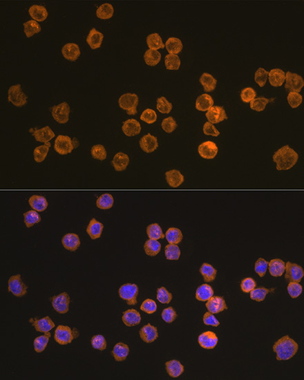 Anti-NLRP3 Antibody (CAB14223)