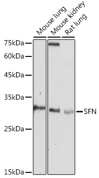 Anti-SFN Antibody (CAB1026)