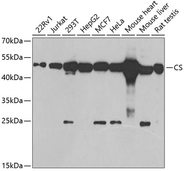 Anti-CS Antibody (CAB5713)