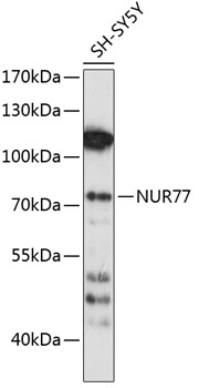 Anti-NUR77 Antibody (CAB0843)