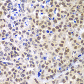 Anti-LHX4 Polyclonal Antibody (CAB8072)