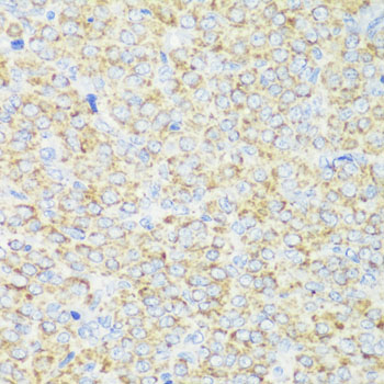 Anti-TOM20 Antibody (CAB6774)