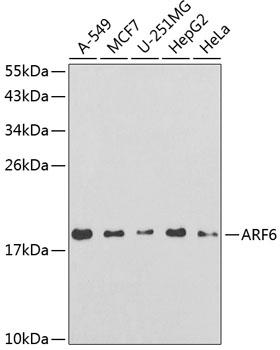 Anti-ARF6 Antibody (CAB3162)
