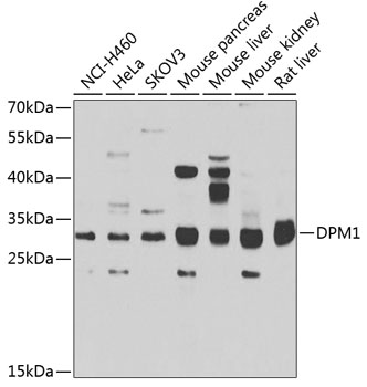 Anti-DPM1 Antibody (CAB7757)