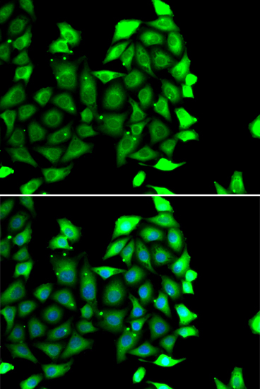 Anti-IKZF3 Antibody (CAB7287)