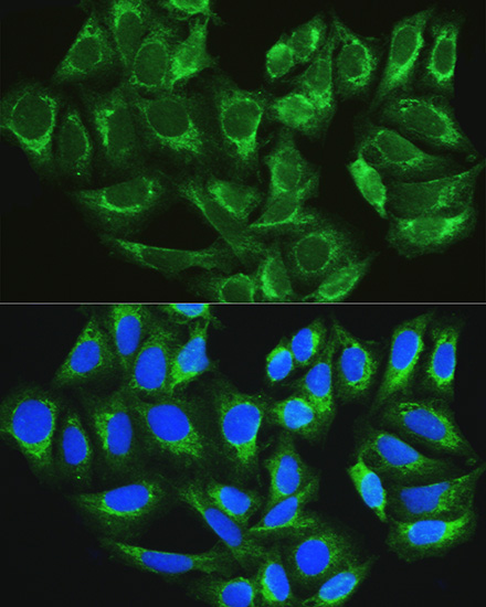 Anti-ATG16L1 Antibody (CAB11969)