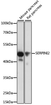 Anti-SERPINI2 Antibody (CAB11732)