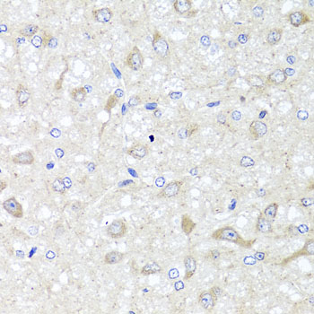 Anti-Interleukin-33 Polyclonal Antibody (CAB8096)