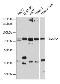 Anti-IL-20RA Antibody (CAB10308)