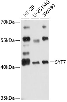 Anti-SYT7 Antibody (CAB12757)