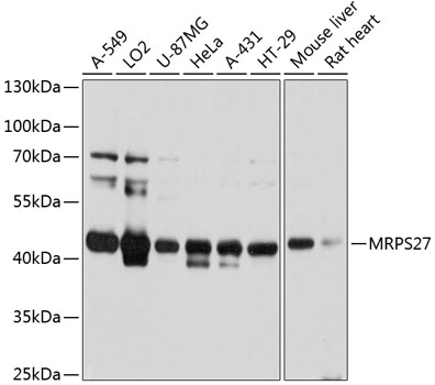 Anti-MRPS27 Antibody (CAB11667)