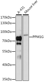 Anti-PPM1G Antibody (CAB12173)