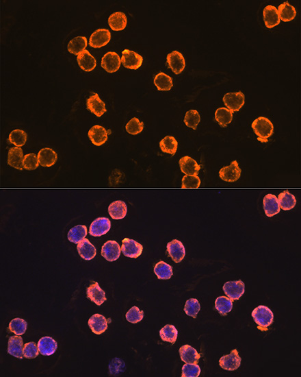 Anti-EMR1 Antibody (CAB1256)