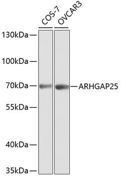 Anti-ARHGAP25 Antibody (CAB1223)