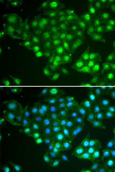 Anti-ABCA3 Antibody (CAB6862)