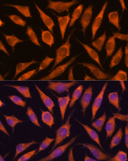 Anti-RPAP3 Antibody (CAB15239)