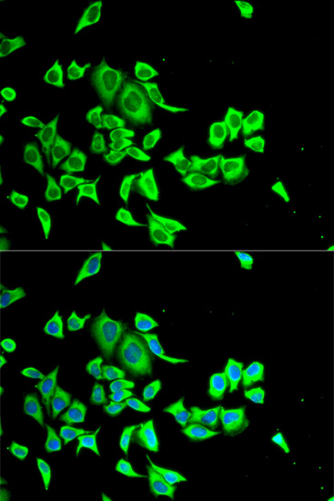 Anti-SERPINB1 Antibody (CAB6257)