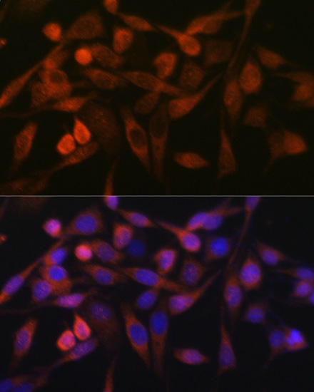 Anti-STIM1 Antibody (CAB7411)