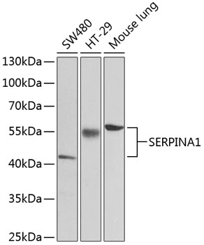 Anti-SERPINA1 Antibody (CAB12481)