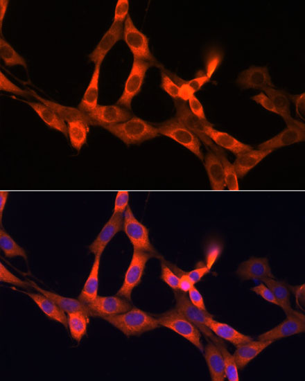 Anti-MCP-1 Antibody (CAB7277)