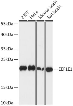 Anti-EEF1E1 Antibody (CAB15357)