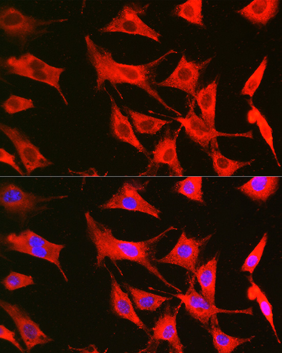 Anti-Bcl-2 Antibody (CAB0208)