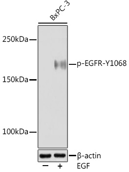 Anti-Phospho-EGFR-Y1068 Antibody (CABP0994)