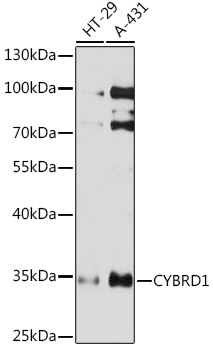 Anti-CYBRD1 Antibody (CAB17215)