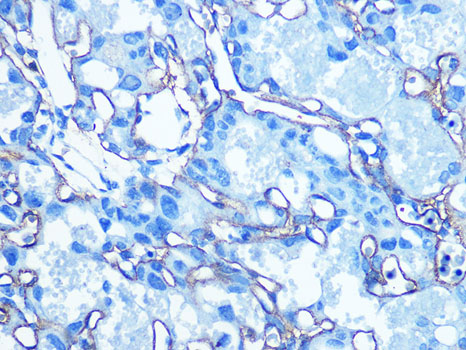 Anti-GLUT1 Antibody (CAB6982)