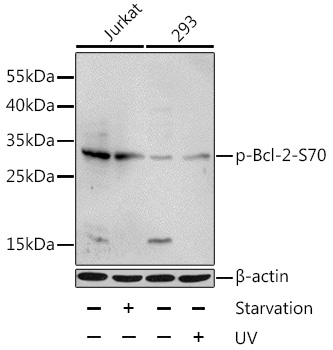 Anti-Phospho-BCL2-S70 Antibody (CABP0575)