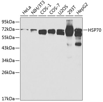 Anti-HSP70 Antibody (CAB0284)