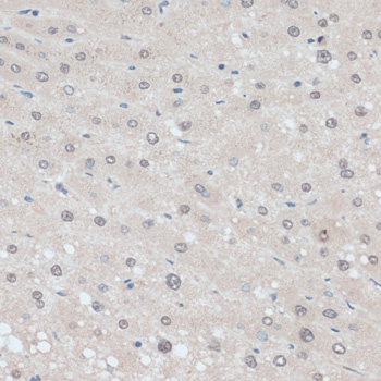 Anti-ZNF707 Antibody (CAB13737)