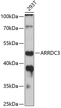 Anti-ARRDC3 Antibody (CAB12262)